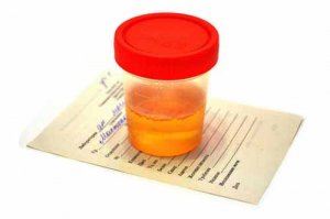 خون در ادرار