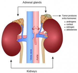 غده فوق کلیه