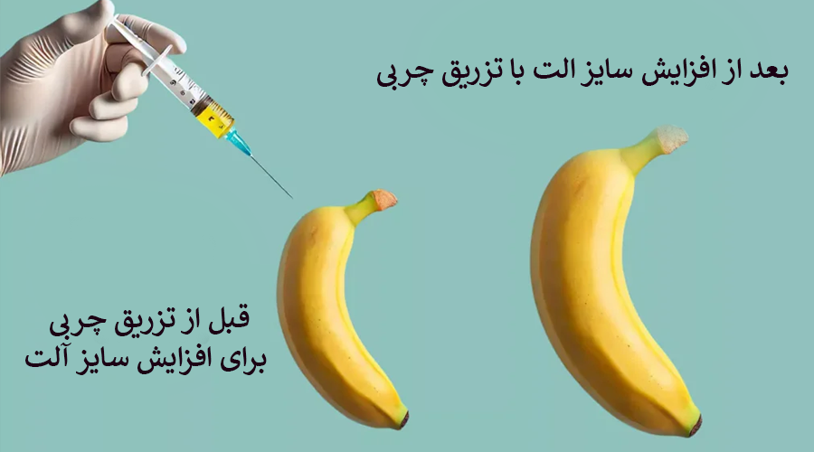 نتایج قبل و بعد افزایش سایز الت با تزریق چربی