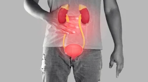 سیستیت یا التهاب مثانه - دکتر کیوان آقامحمدپور
