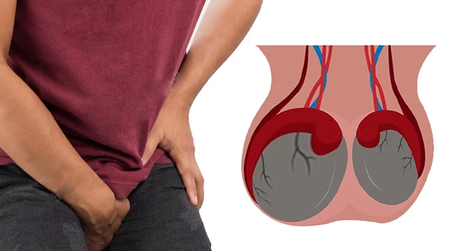 چه کسانی در معرض ابتلا به عفونت بیضه هستند؟