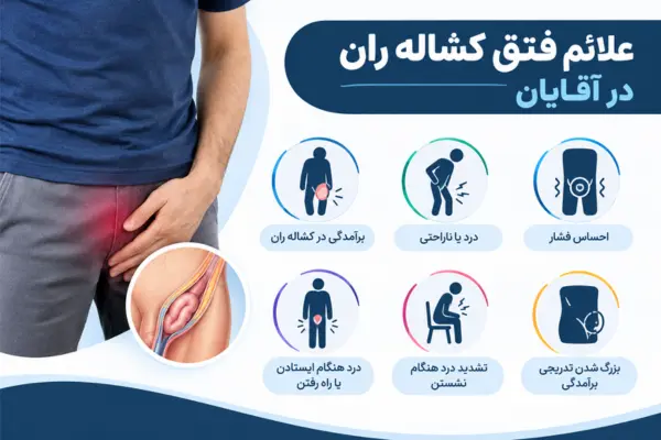 علائم فتق کشاله ران در آقایان