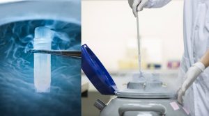 ذخیره سازی اسپرم با فریز اسپرم - دکتر کیوان آقامحمدپور