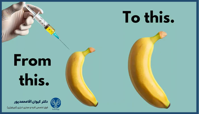 افزایش اندازه آلت تناسلی