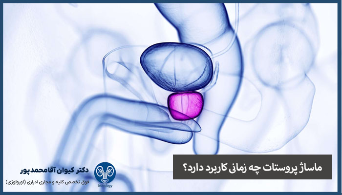 ماساژ پروستات چه زمانی کاربرد دارد؟