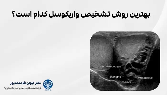 بهترین روش تشخیص واریکوسل کدام است؟