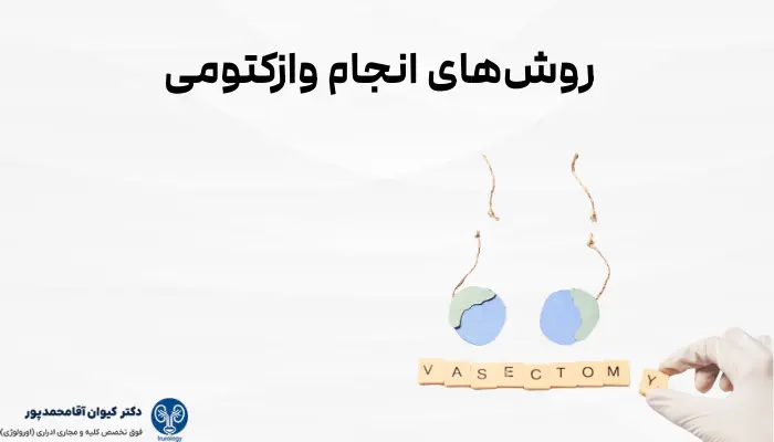 روشهای انجام وازکتومی: