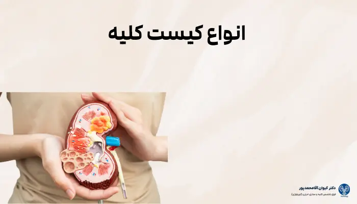 انواع کیست کلیه انواع کیست کلیه انواع کیست کلیه