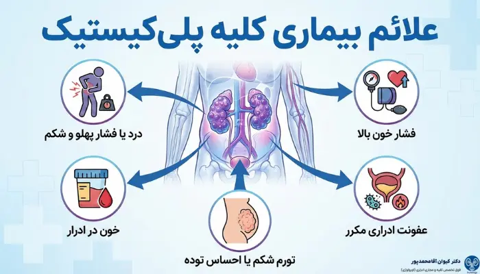 علائم بیماری کلیه پلیکیستیک